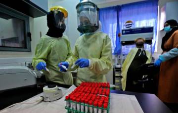 الصحة: تسجيل نحو 100 إصابة بمتحور جديد من فيروس كورونا   